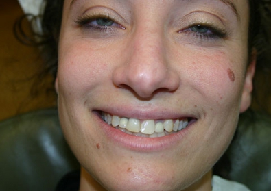 Patient 10 before