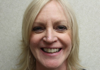 Patient 13 before