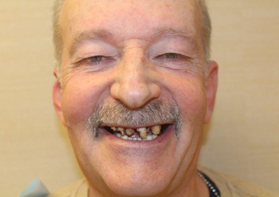 Patient 18 before